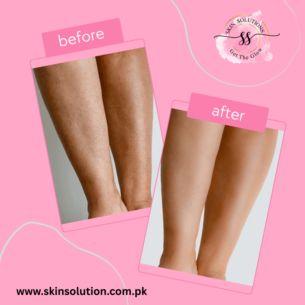 Cotton Candy Glow Body Scrub – For Smooth, Radiant Skin