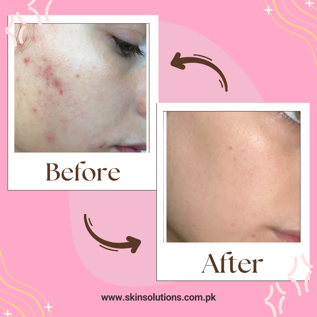 Skin Brightening Herbal Pack β Glow Naturally, Shine Confidently