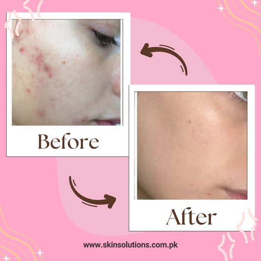 Skin Brightening Herbal Pack – Glow Naturally, Shine Confidently